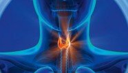thyroide