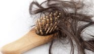 chute des cheveux